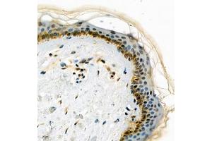 Immunohistochemistry (Paraffin-embedded Sections) (IHC (p)) image for anti-glycerophosphodiester phosphodiesterase Domain Containing 2 (GDPD2) antibody (ABIN7074098)