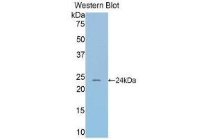 Western Blotting (WB) image for anti-serpin Peptidase Inhibitor, Clade A (Alpha-1 Antiproteinase, Antitrypsin), Member 6 (SERPINA6) (AA 57-256) antibody (ABIN1858267) (SERPINA6 抗体  (AA 57-256))