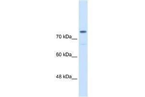 WB Suggested Anti-ACTN4  Antibody Titration: 0. (alpha Actinin 4 抗体  (C-Term))