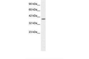 Image no. 1 for anti-Proteasome (Prosome, Macropain) 26S Subunit, Non-ATPase, 14 (PSMD14) (N-Term) antibody (ABIN202214)