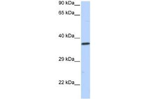 WB Suggested Anti-SCML1 Antibody Titration:  0. (SCML1 抗体  (N-Term))