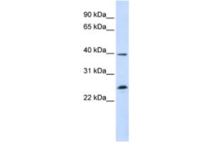 Western Blotting (WB) image for anti-Single-Stranded DNA Binding Protein 2 (SSBP2) antibody (ABIN2460285) (SSBP2 抗体)