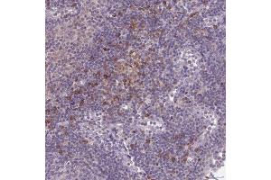 Immunohistochemical staining (Formalin-fixed paraffin-embedded sections) of human lymph node with CD1E polyclonal antibody  shows moderate cytoplasmic positivity in subset of non-germinal center cells. (CD1e 抗体  (AA 79-147))