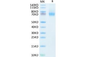 IL7R Protein (Fc Tag)
