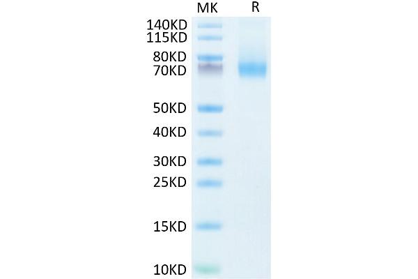 IL7R Protein (Fc Tag)