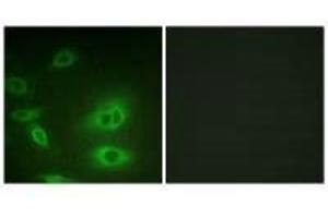 Immunofluorescence analysis of HeLa cells, using ATP1α1/Na+K+ ATPase1 (Ab-23) antibody. (ATP1A1 抗体  (Ser23))