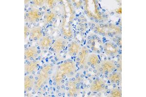 Immunohistochemistry of paraffin-embedded mouse kidney using CYP4A11 antibody at dilution of 1:100 (40x lens). (CYP4A11 抗体)