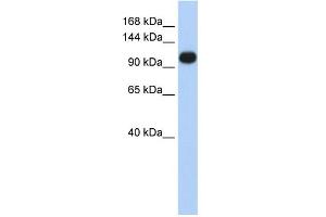 WB Suggested Anti-ATP2A3 Antibody Titration:  0. (ATP2A3 抗体  (Middle Region))