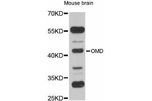 Western blot analysis of extracts of mouse brain, using OMD antibody (ABIN6290709) at 1:1000 dilution. (Osteomodulin 抗体)