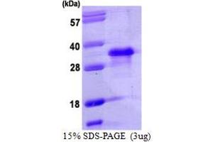 SDS-PAGE (SDS) image for Nanog Homeobox (NANOG) (AA 1-154) protein (His tag) (ABIN667930)