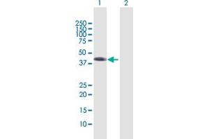 Western Blotting (WB) image for anti-Wingless-Type MMTV Integration Site Family, Member 5B (WNT5B) (AA 1-359) antibody (ABIN529330)