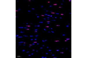 Immunofluorescent analysis of paraffin embedded mouse heart using ubp43 (ABIN7076108) at dilution of 1: 1000 (USP18 抗体)