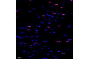 Immunofluorescent analysis of paraffin embedded mouse heart using ubp43 (ABIN7076108) at dilution of 1: 1000 (USP18 抗体)