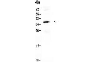 Western blot analysis of CORD2 using anti-CORD2 antibody . (CRX 抗体  (C-Term))