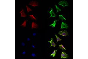 ABIN6264546 and ABIN6272948 staining Hela cells by IF/ICC. (QSOX1 抗体  (Internal Region))