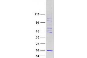Western Blotting (WB) image for CTF8, Chromosome Transmission Fidelity Factor 8 (CHTF8) (Transcript Variant 1) protein (Myc-DYKDDDDK Tag) (ABIN2718883)