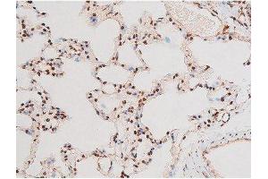 ABIN6267601 at 1/200 staining Rat lung tissue sections by IHC-P. (NF-kB p65 抗体  (pThr435))