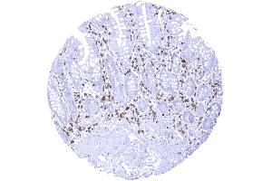 Strong CD5 immunostaining of T lymphocytes in the ileum mucosa (Recombinant CD5 抗体  (AA 32-372))