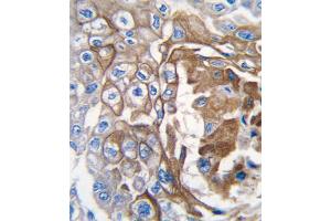 Immunohistochemistry (IHC) image for anti-GTPase NRas (NRAS) antibody (ABIN3003468) (GTPase NRas 抗体)