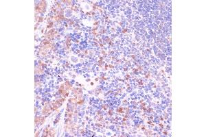 Immunohistochemistry of paraffin-embedded mouse spleen using UGT2B15 antibody (ABIN7271194) at dilution of 1:100 (40x lens). (UGT2B15 抗体  (AA 60-190))