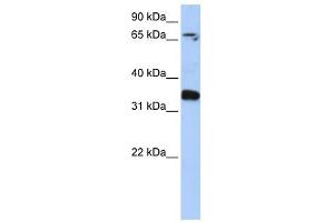 GLE1 antibody used at 1 ug/ml to detect target protein. (GLE1 抗体)