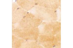 Immunohistochemical anyalysis of mouse skeletal muscle tissue with PRC1 polyclonal antibody  at 2. (PRC1 抗体  (Internal Region))