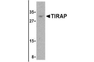 Image no. 1 for anti-Toll-Interleukin 1 Receptor (TIR) Domain Containing Adaptor Protein (TIRAP) (Middle Region) antibody (ABIN265135) (TIRAP 抗体  (Middle Region))