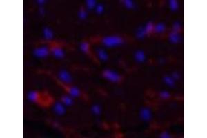 Immunofluorescence analysis of Mouse heart tissue using CD1A Monoclonal Antibody at dilution of 1:200. (CD1a 抗体)