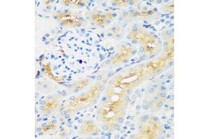 Immunohistochemistry of paraffin-embedded rat kidney using PROCR antibody. (PROCR 抗体  (AA 19-209))