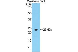 Western blot analysis of the recombinant protein. (PPARG 抗体  (AA 311-493))