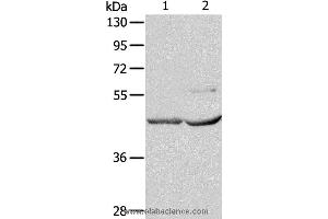 Western blot analysis of Mouse kidney and heart tissue, using NCEH1 Polyclonal Antibody at dilution of 1:1350 (NCEH1 抗体)