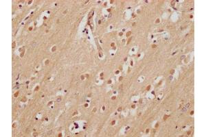 IHC image of ABIN7165518 diluted at 1:200 and staining in paraffin-embedded human brain tissue performed on a Leica BondTM system. (Fam53a 抗体  (AA 135-398))