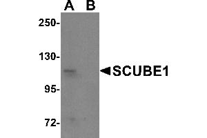 Western Blotting (WB) image for anti-Signal Peptide, CUB Domain, EGF-Like 1 (SCUBE1) (Middle Region) antibody (ABIN1031082) (SCUBE1 抗体  (Middle Region))