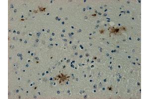Immunohistochemistry (IHC) image for anti-Syndecan Binding Protein (Syntenin) (SDCBP) antibody (ABIN1742301) (SDCBP 抗体)
