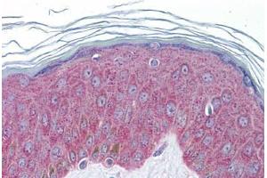 Human Skin: Formalin-Fixed, Paraffin-Embedded (FFPE) (IL-33 抗体  (AA 36-85))