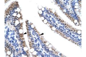 ZNF12 antibody was used for immunohistochemistry at a concentration of 4-8 ug/ml to stain Epithelial cells of intestinal villus (arrows) in Human Intestine. (ZNF12 抗体  (N-Term))