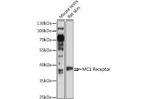 Western blot analysis of extracts of various cell lines, using MC1 Receptor antibody (ABIN6132878, ABIN6143610, ABIN6143612 and ABIN6217539) at 1:1000 dilution. (MC1 Receptor 抗体  (AA 1-80))