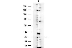 anti-Anaphase Promoting Complex Subunit 11 (ANAPC11) antibody