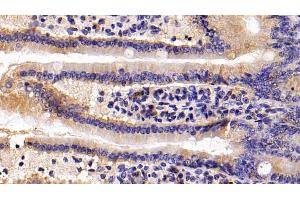 Immunohistochemistry (IHC) image for anti-S100 Calcium Binding Protein A8 (S100A8) (AA 1-89) antibody (ABIN7434065)