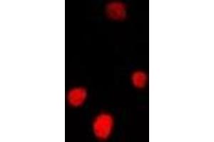 Immunofluorescent analysis of FGF14 staining in U2OS cells. (FGF14 抗体)