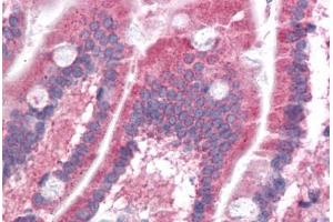 Immunohistochemistry (Formalin-fixed Paraffin-embedded Sections) (IHC (fp)) image for anti-Phosphatidic Acid Phosphatase Type 2 Domain Containing 1B (PPAPDC1B) (N-Term) antibody (ABIN604711)