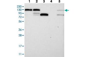 Western blot analysis of Lane 1: RT-4, Lane 2: U-251 MG, Lane 3: Human Plasma, Lane 4: Liver, Lane 5: Tonsil with DDX46 polyclonal antibody .