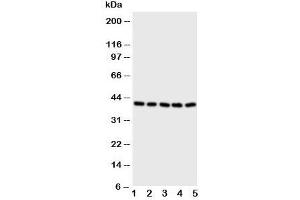 Western blot testing of BCAT2 antibody and Lane 1:  A431;  2: SW620;  3: SMMC-7721;  4: Jurkat;  5: CEM cell lysate (BCAT2 抗体  (C-Term))