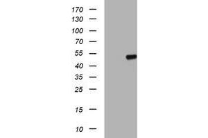 Western Blotting (WB) image for anti-Adipocyte Plasma Membrane Associated Protein (APMAP) antibody (ABIN1496662) (APMAP 抗体)