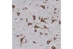 Immunohistochemical staining of human cerebral cortex with CTAGE5 polyclonal antibody  shows strong cytoplasmic positivity in neuronal cells.