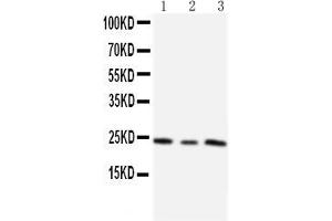 Anti-TIMP4 antibody, Western blotting Lane 1: HT1080 Cell Lysate Lane 2: HELA Cell Lysate Lane 3: SMMC Cell Lysate (TIMP4 抗体  (C-Term))