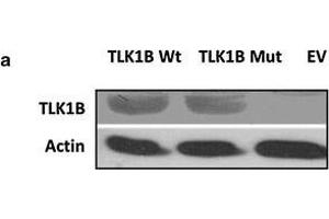 a Overexpression of Wt TLK1B and Mut TLK1B in stably transfected HEK293 cells. (TLK1 抗体)
