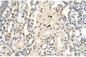 Rabbit Anti-PUF60 Antibody  Paraffin Embedded Tissue: Human Kidney Cellular Data: Epithelial cells of renal tubule Antibody Concentration: 4. (PUF60 抗体  (C-Term))