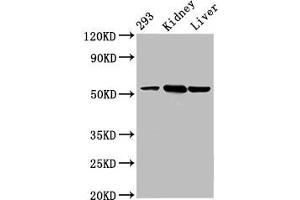 Western Blot Positive WB detected in: 293 whole cell lysate, Mouse kidney tissue, Mouse liver tissue All lanes: DBT antibody at 4. (DBT 抗体  (AA 140-259))