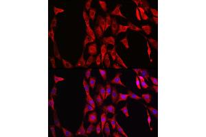 Immunofluorescence analysis of NIH/3T3 cells using LDHA Rabbit mAb  at dilution of 1:100 (40x lens). (Lactate Dehydrogenase A 抗体)